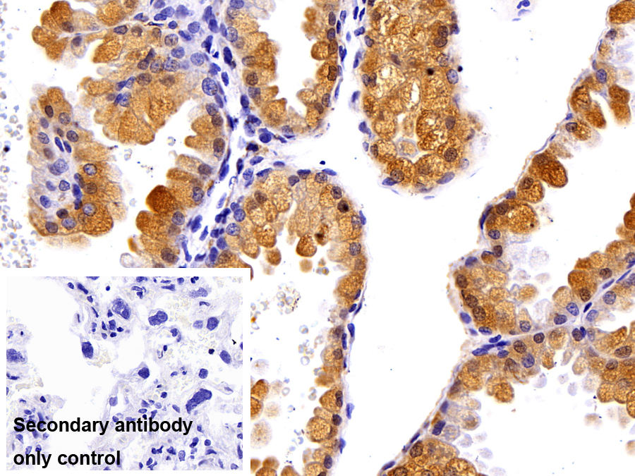 Polyclonal Antibody to High Mobility Group AT Hook Protein 1 (HMGA1)