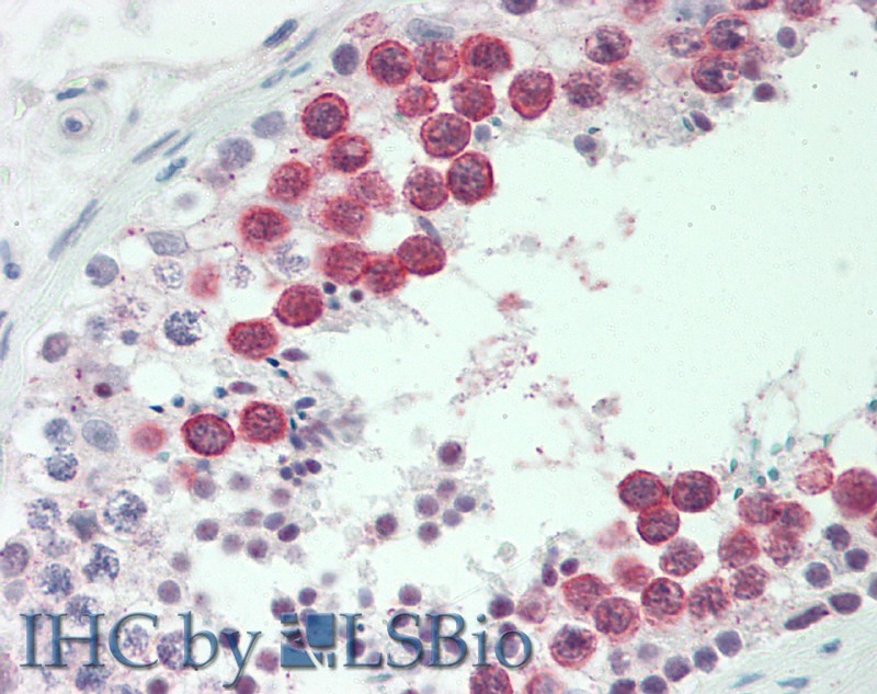 Polyclonal Antibody to Hyaluronan Mediated Motility Receptor (HMMR)