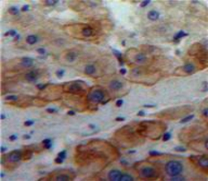 Polyclonal Antibody to Laminin Alpha 4 (LAMa4)