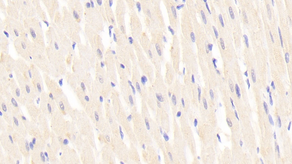 Polyclonal Antibody to Laminin Beta 2 (LAMb2)