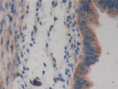 Polyclonal Antibody to Laminin Beta 3 (LAMb3)