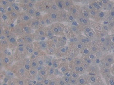 Polyclonal Antibody to Laminin Gamma 1 (LAMC1)