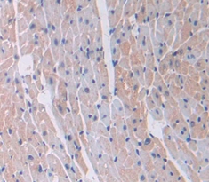 Polyclonal Antibody to Laminin Gamma 2 (LAMC2)