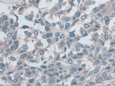 Polyclonal Antibody to Major Histocompatibility Complex Class I B (MHCB)