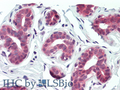 Polyclonal Antibody to Integrin Beta 6 (ITGb6)