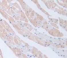 Polyclonal Antibody to Bone Morphogenetic Protein 5 (BMP5)