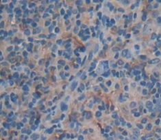 Polyclonal Antibody to Bone Morphogenetic Protein 8A (BMP8A)