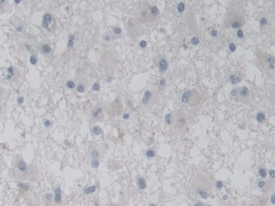 Polyclonal Antibody to Activin A Receptor Type I C (ACVR1C)