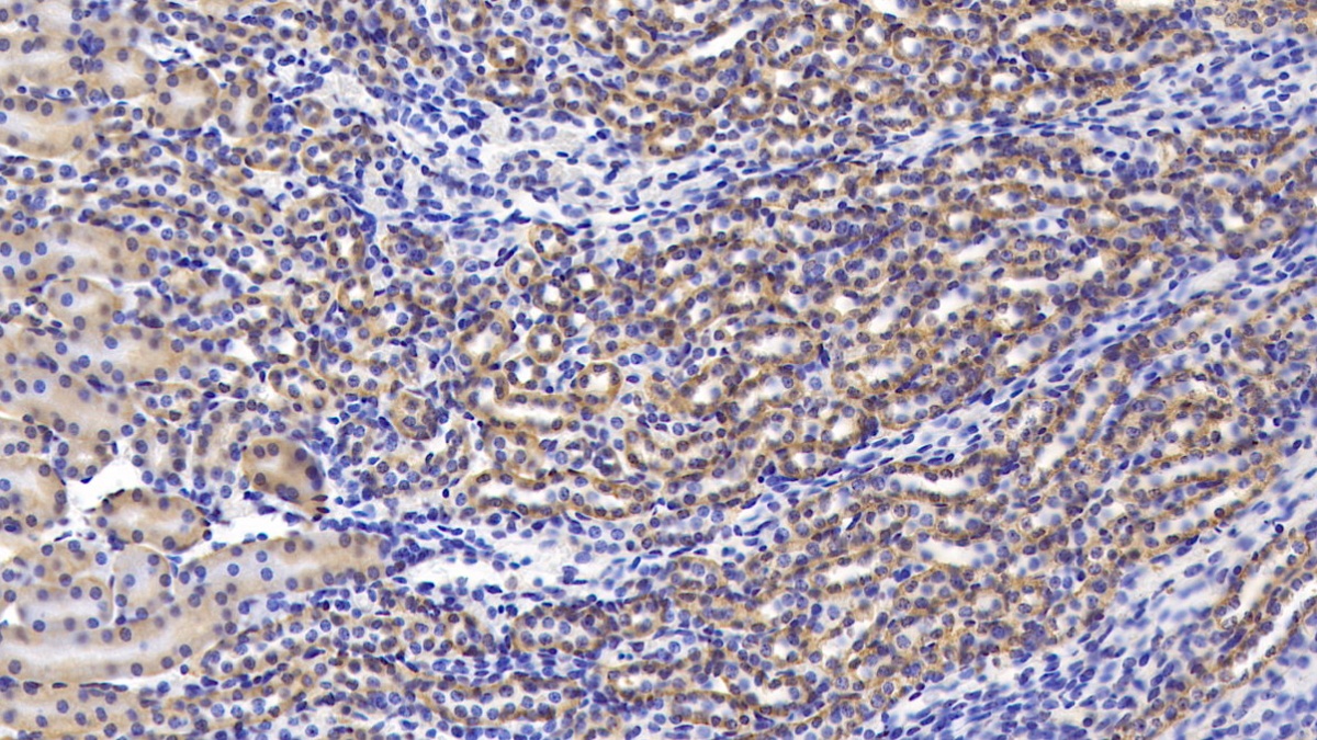 Polyclonal Antibody to Activin A Receptor Type II A (ACVR2A)