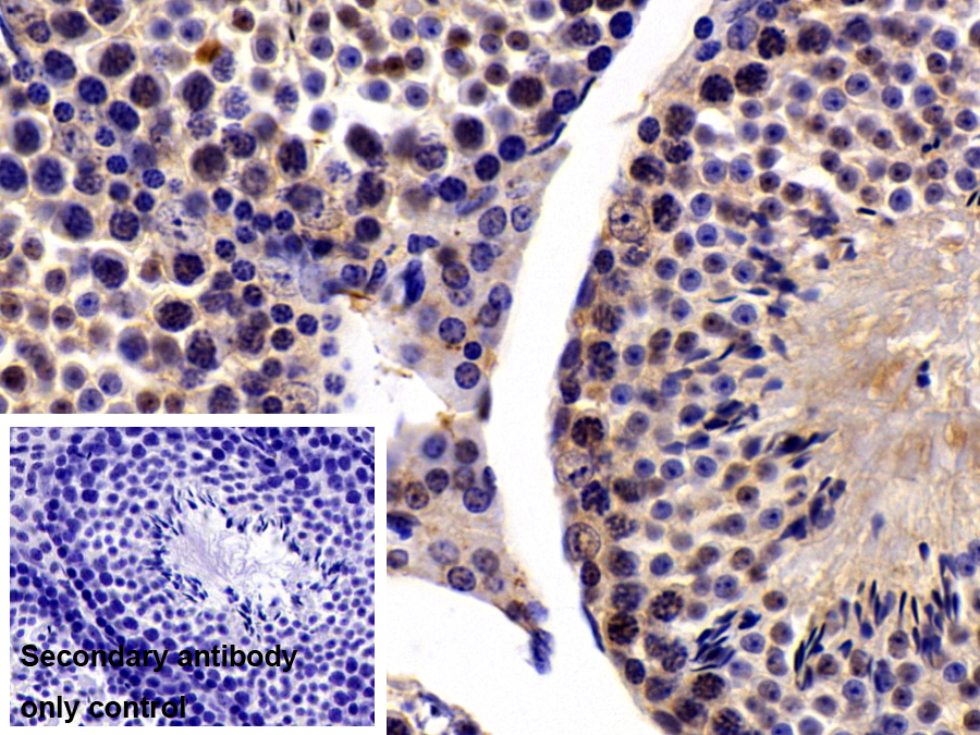 Polyclonal Antibody to Mothers Against Decapentaplegic Homolog 2 (Smad2)