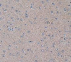 Polyclonal Antibody to Noggin (NOG)