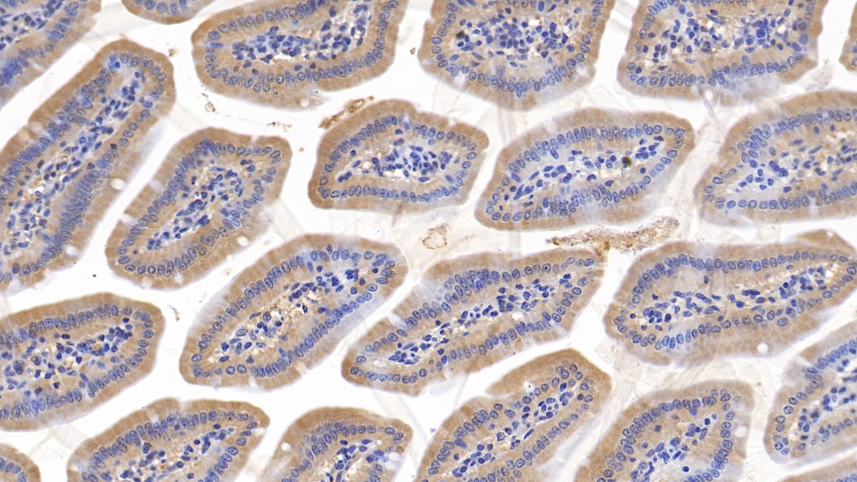 Polyclonal Antibody to Collagen Type XVIII (COL18)