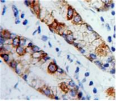 Polyclonal Antibody to Collagen Type XVII (COL17)