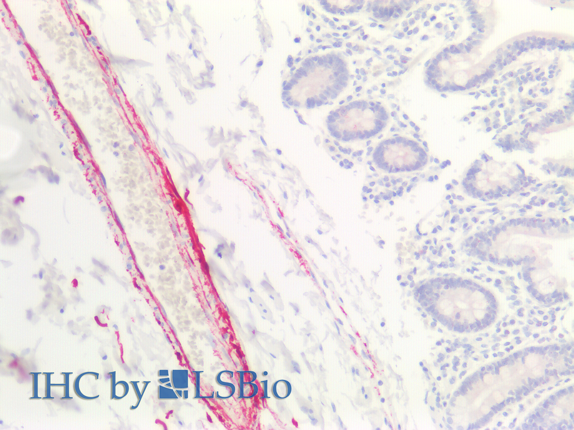 Polyclonal Antibody to Collagen Type VIII Alpha 1 (COL8a1)