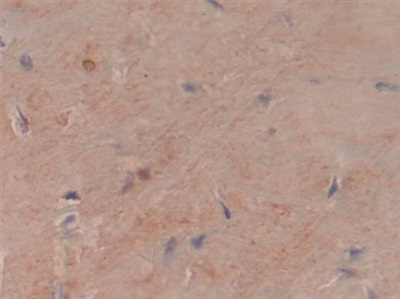 Polyclonal Antibody to Collagen Type VI Alpha 3 (COL6a3)