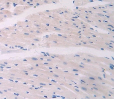 Polyclonal Antibody to Collagen Type VI Alpha 1 (COL6a1)