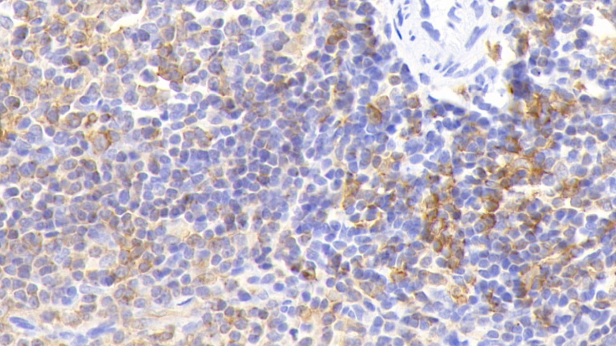 Polyclonal Antibody to HLA Class II Histocompatibility Antigen, DR Alpha Chain (HLA-DRA)