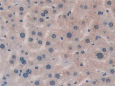 Polyclonal Antibody to HLA Class II Histocompatibility Antigen, DRB1 Beta Chain (HLA-DRB1)