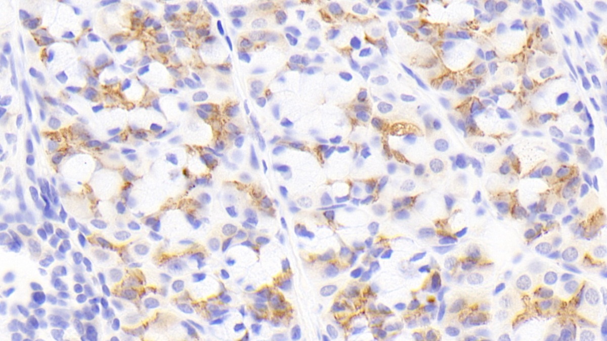 Polyclonal Antibody to Neuregulin 4 (NRG4)