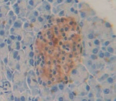 Polyclonal Antibody to Neuregulin 4 (NRG4)