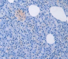 Polyclonal Antibody to Left/Right Determination Factor 1 (LEFTY1)