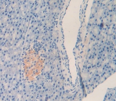 Polyclonal Antibody to Left/Right Determination Factor 1 (LEFTY1)