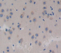 Polyclonal Antibody to Neurocan (NCAN)