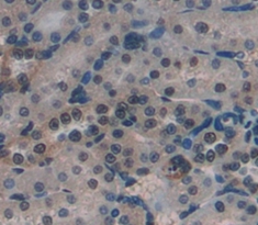 Polyclonal Antibody to Neurocan (NCAN)