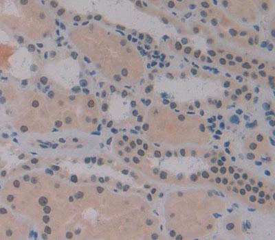 Polyclonal Antibody to Interferon Regulatory Factor 2 (IRF2)