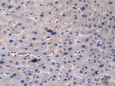 Polyclonal Antibody to Beta Adrenergic Receptor Kinase (BARK)