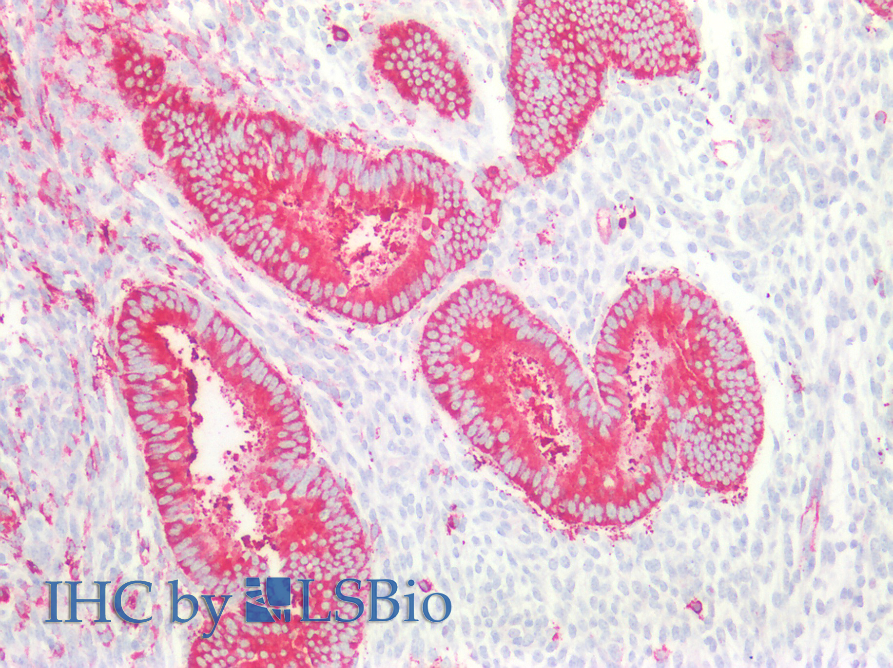 Polyclonal Antibody to Protein Phosphatase 1, Regulatory Subunit 15A (PPP1R15A)