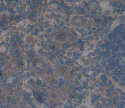 Polyclonal Antibody to Protein Phosphatase 1, Regulatory Subunit 15A (PPP1R15A)