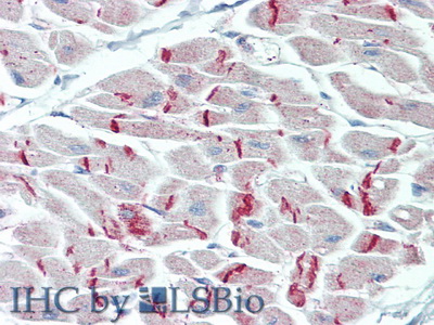 Polyclonal Antibody to Desmoplakin (DSP)