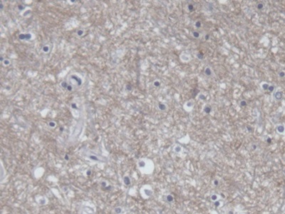 Polyclonal Antibody to Amphiphysin (AMPH)