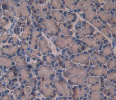 Polyclonal Antibody to Amphiphysin (AMPH)