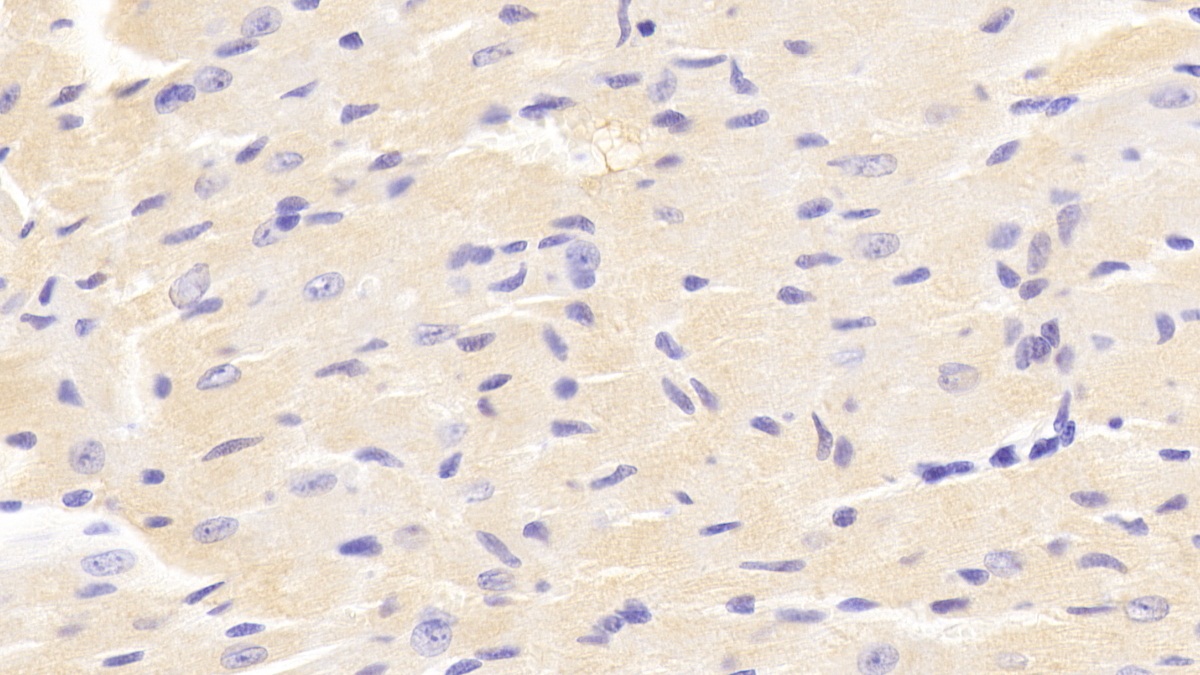 Polyclonal Antibody to Vav 1 Oncogene (VAV1)