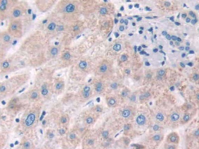 Polyclonal Antibody to Filamin A Alpha (FLNa)