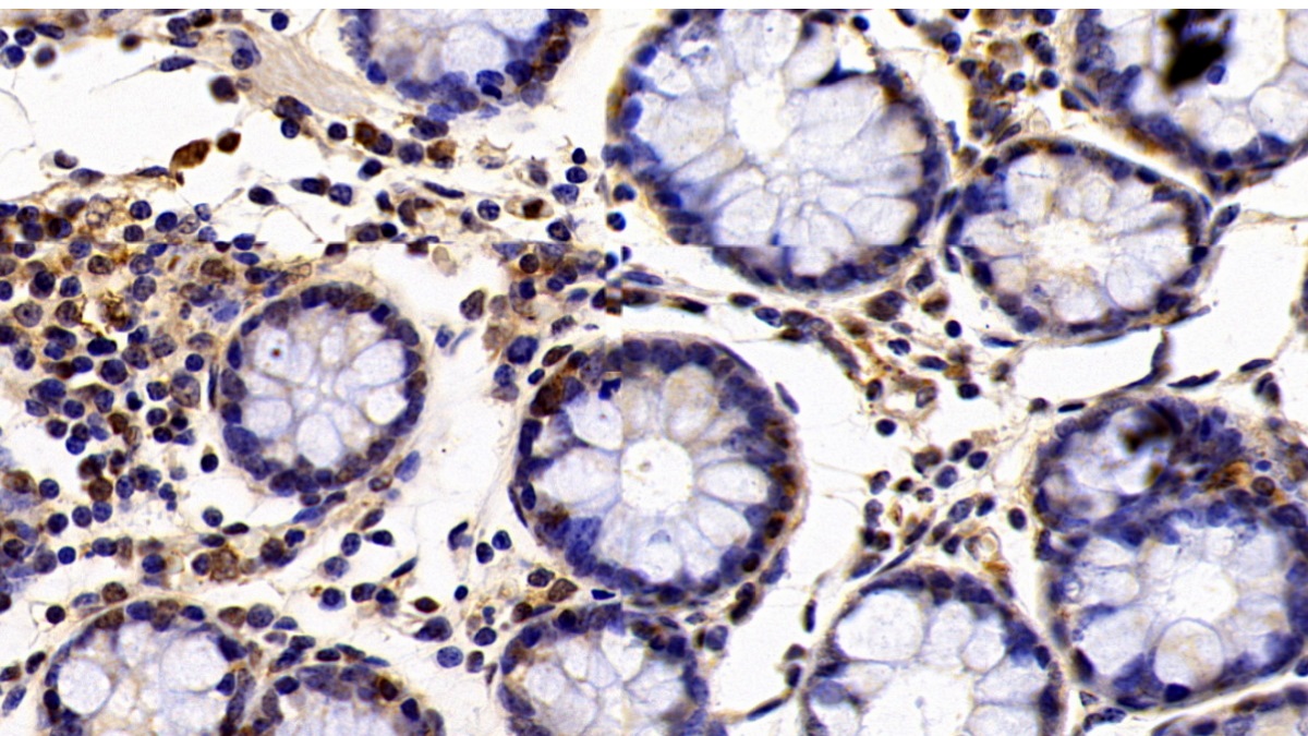 Polyclonal Antibody to E1A Binding Protein P300 (EP300)