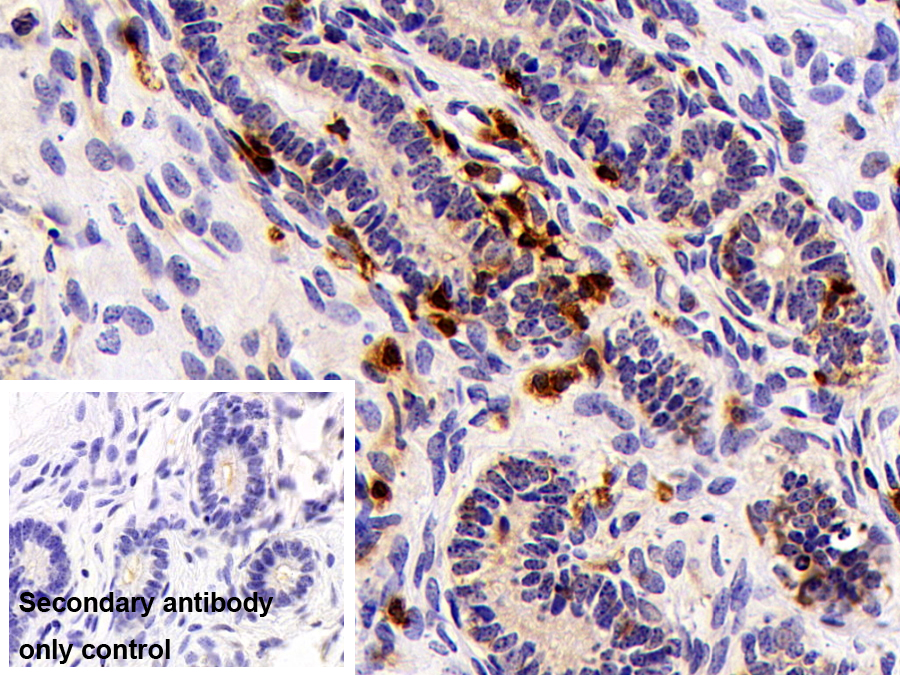 Polyclonal Antibody to Profilin 1 (PFN1)