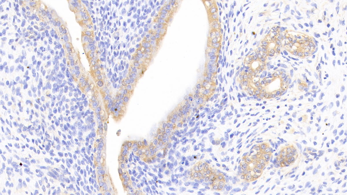 Polyclonal Antibody to Cortactin (CTTN)