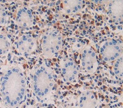 Polyclonal Antibody to Thyroid Hormone Receptor Alpha (THRa)