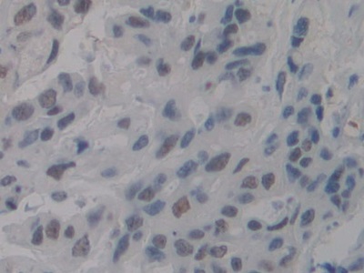 Polyclonal Antibody to Nucleolin (NCL)