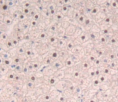 Polyclonal Antibody to Serine/Arginine Rich Splicing Factor 1 (SRSF1)