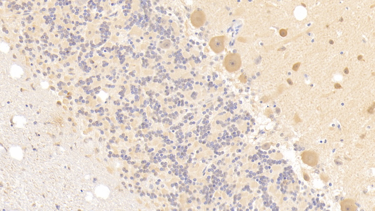 Polyclonal Antibody to Deoxyribonuclease II (DNASEII)