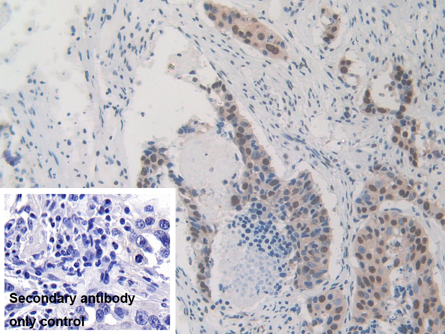 Polyclonal Antibody to Heterogeneous Nuclear Ribonucleoprotein A1 (HNRNPA1)