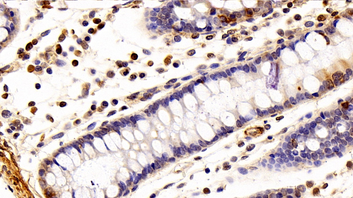 Polyclonal Antibody to Exportin 1 (XPO1)