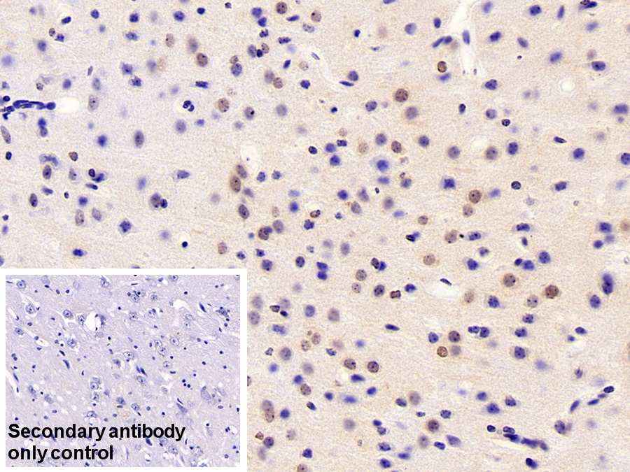 Polyclonal Antibody to Fusion (FUS)