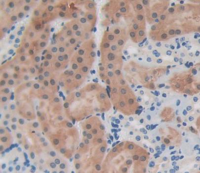 Polyclonal Antibody to Erythrocyte Membrane Protein Band 4.1 (EPB41)