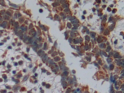 Polyclonal Antibody to Disrupted In Schizophrenia 1 (DISC1)