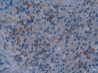 Polyclonal Antibody to Disrupted In Schizophrenia 1 (DISC1)